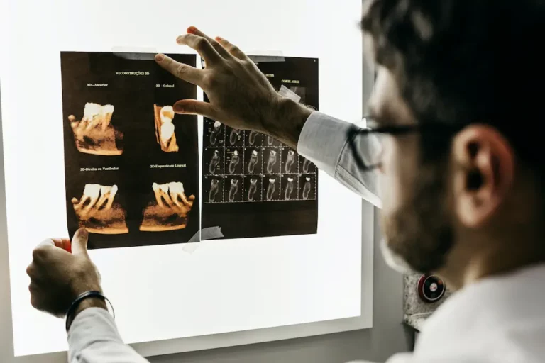 Dr. examinando tomografía computarizada.